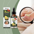 Aceite anti-hongos uñas nueva fórmula